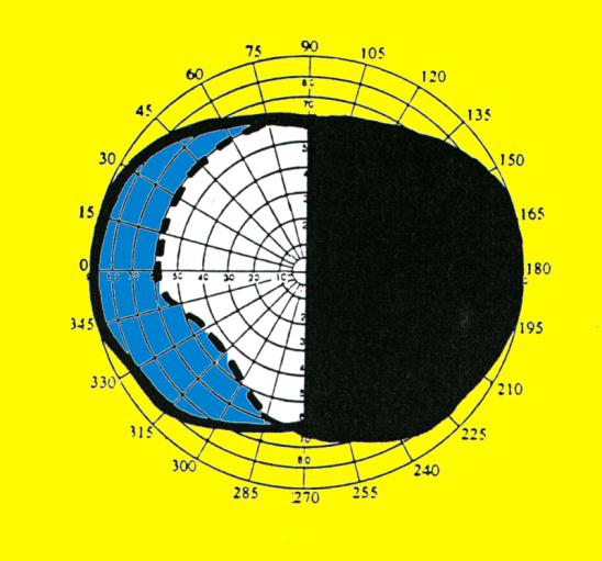 HEMIANOPSIA_DERECHA3