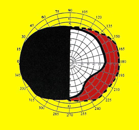 HEMIANOPSIA_IZQUIERDA3