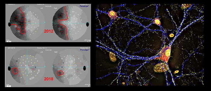 Neurorehabilitacion_visual-1